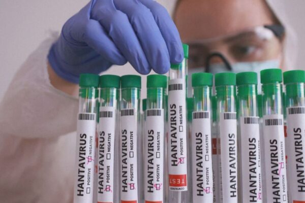 Especialista avalia por que surtos de Ebola e Hantavírus têm baixo risco de pandemia